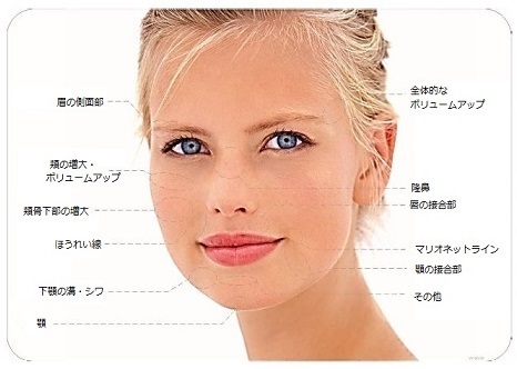 キャプチャ1.jpg